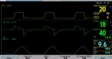 respiratori pressometrici