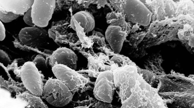 Yersinia Pestis Batterio Peste